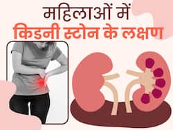 किडनी में पथरी होने पर महिलाओं के शरीर में दिखते हैं ये लक्षण, सामान्य समझकर अधिकतर लोग करते हैं इग्नोर