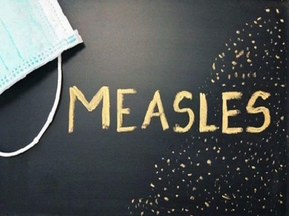 Measles Cases Rise To 64 In US: Total Number Of Cases Cross 2023 Levels Reports CDC | TheHealthSite.com - TheHealthSite