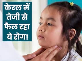 केरल में तेजी से फैल रहा Mumps, जानिए क्या है ये रोग और कैसे करें इससे बचाव