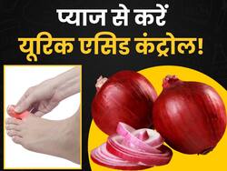 बढ़े हुए यूरिक एसिड को कम करने में असरदार है प्याज, बस इस तरह करें इस्तेमाल
