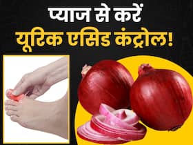 बढ़े हुए यूरिक एसिड को कम करने में असरदार है प्याज, बस इस तरह करें इस्तेमाल बढ़े हुए यूरिक एसिड को कम करने में असरदार है प्याज, बस इस तरह करें इस्तेमाल