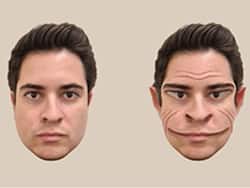 US Man Diagnosed With 'Demonic' Disorder Prosopometamorphopsia: Know More About It