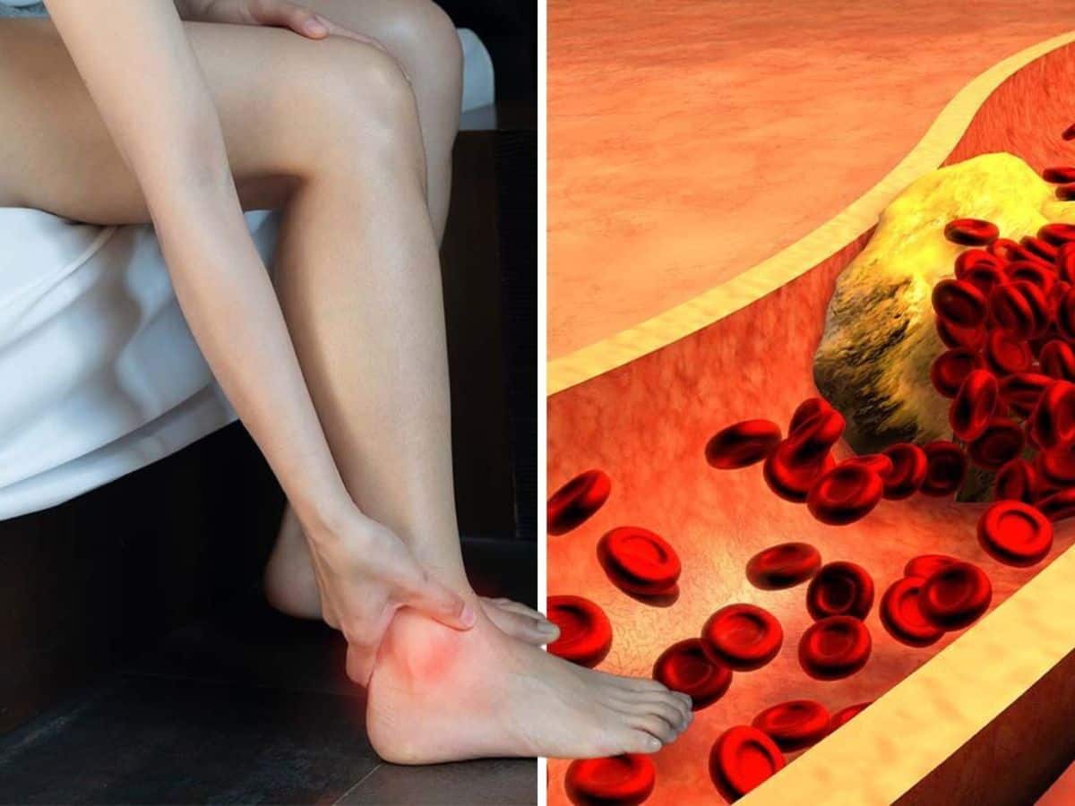 Heart Blockage Diet Remedies: Top 7 Heart Cleansing Ayurvedic Drinks That Can Help Clean Clogged Arteries Naturally - Vimarsana News