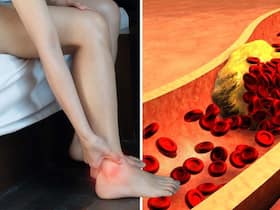 Heart Blockage Diet Remedies: Top 7 Heart Cleansing Ayurvedic Drinks That Can Help Clean Clogged Arteries Naturally