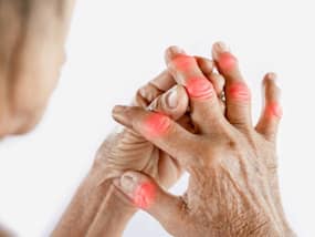 High Uric Acid Symptoms In Men 30s: Top 7 Unusual Signs of High Uric Acid In Hands And Fingers