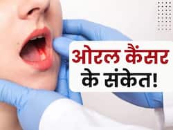 दांतों में दर्द और मसूड़ों से खून आना ओरल कैंसर का हो सकते हैं संकेत, सावधानी बरतने से टल सकता है खतरा
