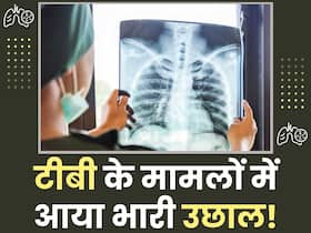 पिछले साल क्यों आए टीबी के 25 लाख मामले? जानिए किन कारणों से बढ़ते हैं टीबी के केस पिछले साल क्यों आए टीबी के 25 लाख मामले? जानिए किन कारणों से बढ़ते हैं टीबी के केस