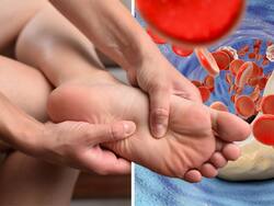 High Cholesterol Symptoms In Men At Night: 7 Unusual Signs of High Bad LDL Cholesterol In Legs And Feet