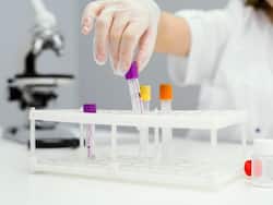 विटामिन्स टेस्ट समय-समय पर कराना है बहुत ही जरूरी, गंभीर बीमारियों से रहते हैं सुरक्षित