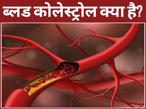 High Cholesterol से बढ़ता है ब्रेन स्ट्रोक का खतरा, शरीर में दिखते हैं ये 5 संकेत, हल्के में लेने की भूल ने करें