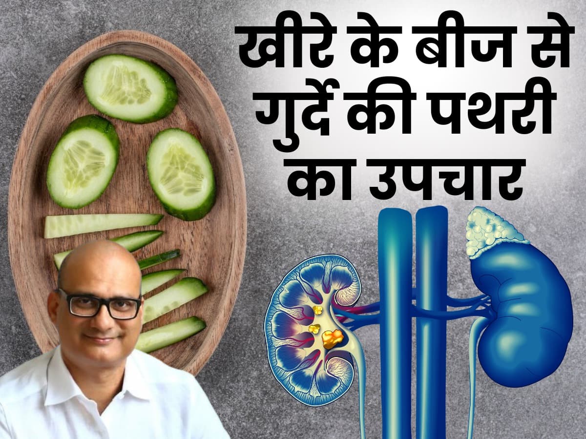 Recurrence of kidney stone किडनी स्टोन का परमानेंट उपचार है खीरे का