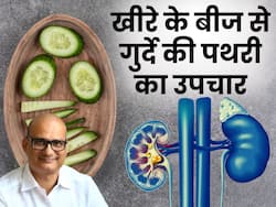 किडनी स्टोन का परमानेंट उपचार है खीरे का बीज! Ayurveda Doctor ने बताया पथरी से निजात पाने के उपाय