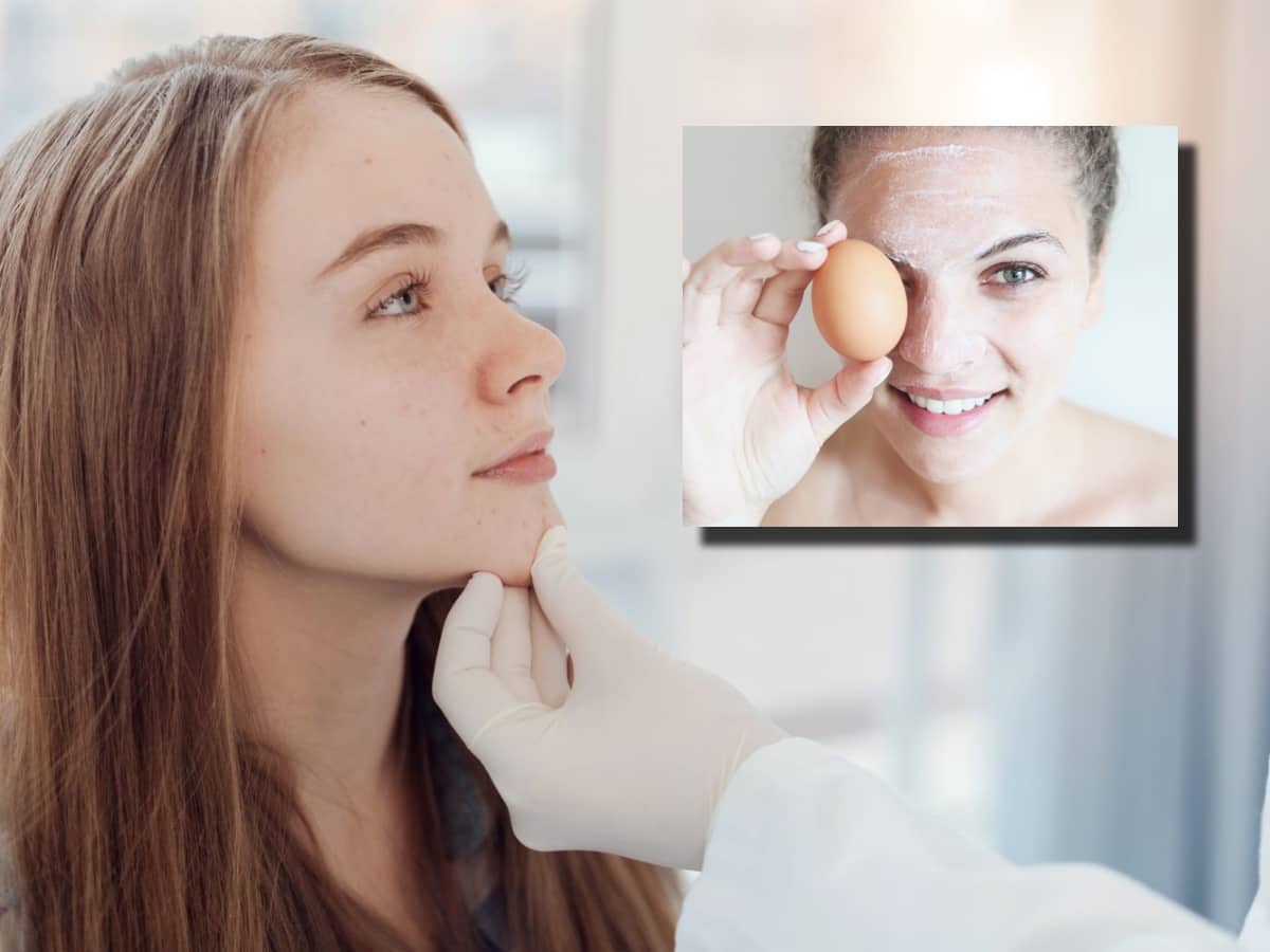 Egg for skin सिर्फ बॉडी बनाने के लिए ही नहीं नेचुरल ग्लो वापस पाने के