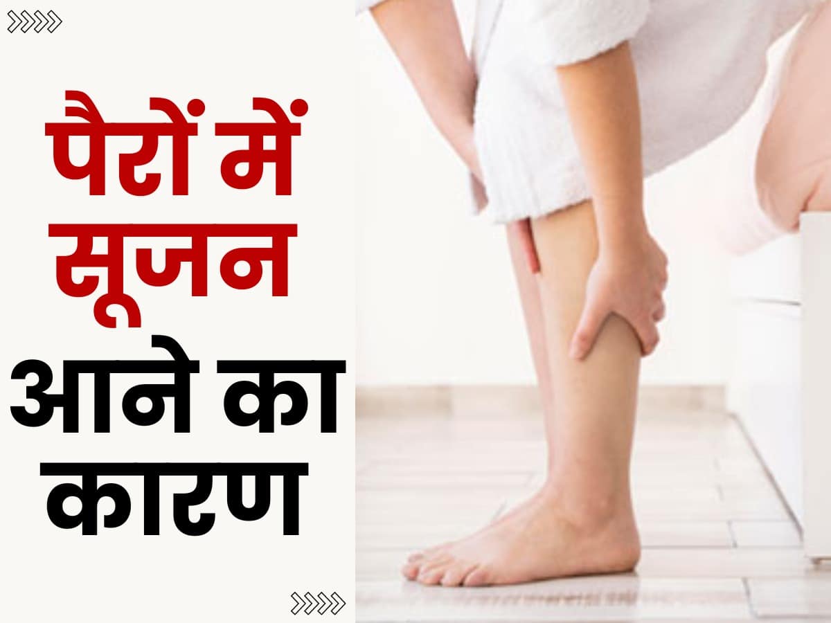 ज्यादा देर बैठने और खड़े रहने से पैरों में सूजन आने का कारण और उपचार