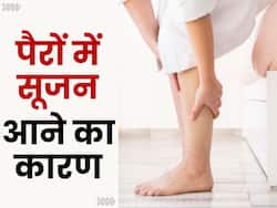ज्यादा देर बैठने और खड़े रहने से पैरों में आ जाती है सूजन? जानें इसका कारण और बचाव के टिप्स