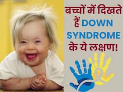 नवजात में दिखें ये 5 लक्षण, तो तुरंत समझ जाएं कि डाउन सिंड्रोम का है खतरा