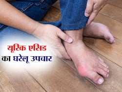 शरीर में बन रहे यूरिक एसिड के जाल को तोड़ेंगे ये हेल्दी फूड्स, जानिए 5 जबरदस्त उपाय