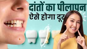 Teeth Whitening Remedies: दांतों का पीलापन दूर करेंगे ये घरेलू उपाय