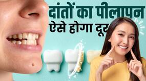Teeth Whitening Remedies: दांतों का पीलापन दूर करेंगे ये घरेलू उपाय