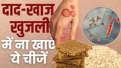 Ringworm Prevention Tips: दाद-खाज खुजली से परेशान लोग गलती से भी ना खाएं ये चीजें