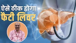 Fatty Liver ka ilaaj: जानें फैटी लिवर का आयुर्वेदिक इलाज,अपनाएं ये तरीका