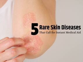 Don't Ignore These! 5 Rare Skin Diseases That Demand Urgent Medical Attention