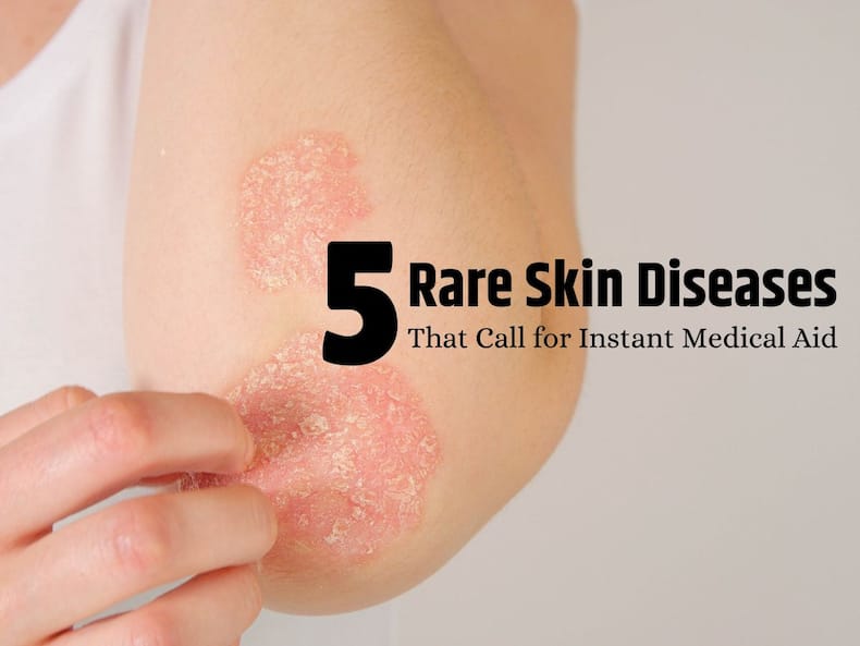thehealthsite.com top news