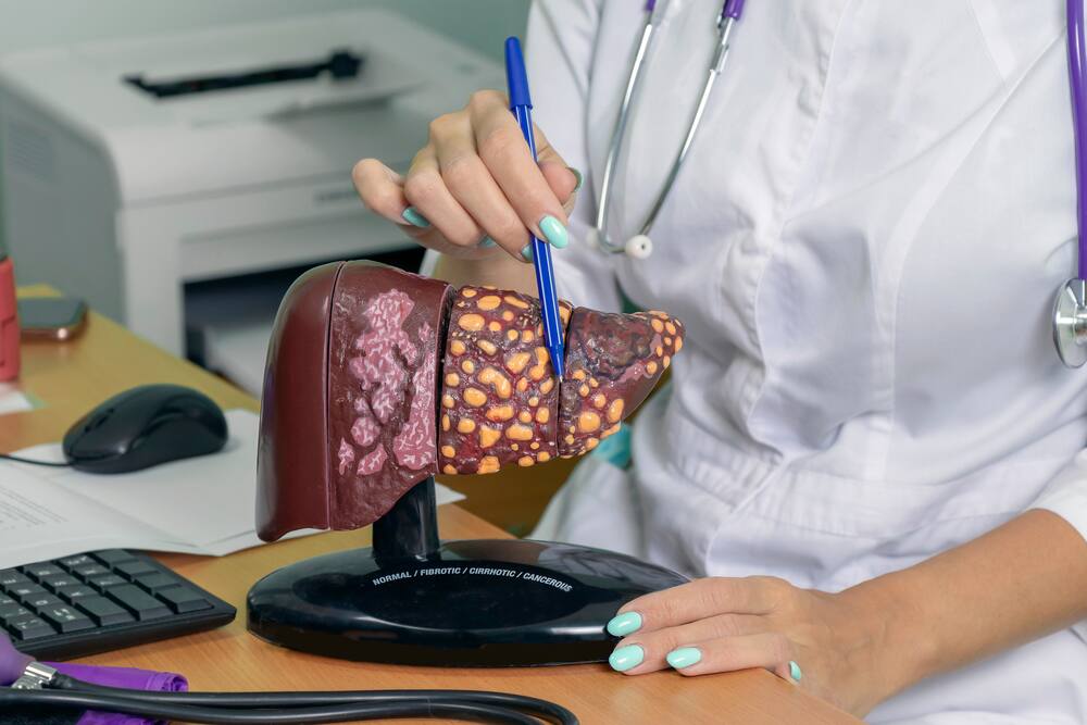 Role Of Lifestyle Modifications In Liver Disease Management: Strategies For Improved Patient Outcomes - Vimarsana News