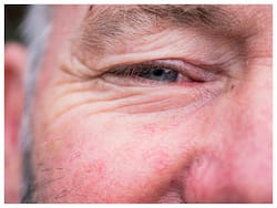 Diabetic Retinopathy Management Diet Tips: How To Prevent Eye Problems Due To High Blood Sugar