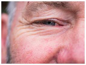 Diabetic Retinopathy Management Diet Tips: How To Prevent Eye Problems Due To High Blood Sugar