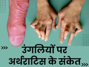 उंगलियों में दिखने वाले ये 5 संकेत अर्थराइटिस की ओर करते हैं इशारा, तुरंत लें अपने डॉक्टर से सलाह