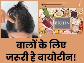 बालों की मजबूती के लिए बायोटीन (Vitamin B7) है जरूरी, डायटीशिन से जानिए कैसे करें इसकी पूर्ति