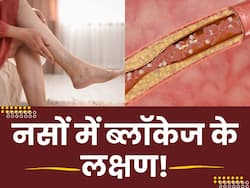 शरीर में दिख रहे हैं ये लक्षण तो समझ जाएं नसें हो रही हैं ब्लॉक, बिना देर किए पहुंच जाएं डॉक्टर के पास