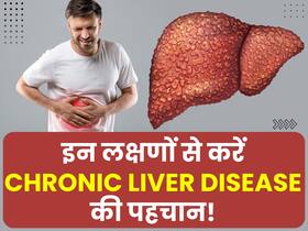 शरीर में दिखाई दें ये लक्षण तो समझ जाएं क्रॉनिक लिवर डिजीज की हो चुकी है शुरुआत, जानें क्या है ये बीमारी? शरीर में दिखाई दें ये लक्षण तो समझ जाएं क्रॉनिक लिवर डिजीज की हो चुकी है शुरुआत, जानें क्या है ये बीमारी?