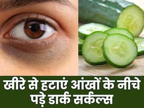 डार्क सर्कल्स को दूर करने में कारगर है खीरा, इन 3 तरीकों से करें इस्तेमाल