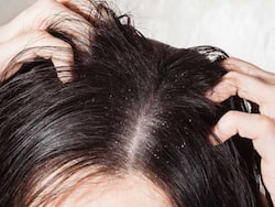 डैंड्रफ को कम करने में फायदेमंद हो सकती हैं ये 3 आयुर्वेदिक जड़ी-बूटियां, जानें हर्ब के नाम और तरीका