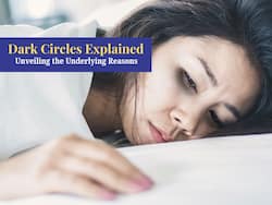 Dark Circles: Beyond Tired Eyes, Here Is What They Reveal About Your Health