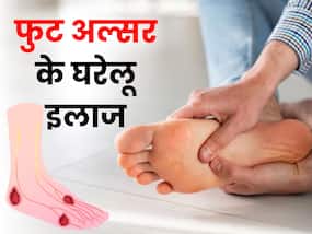 Diabetic फुट अल्सर के कारण पैर हो सकते हैं खराब, डायबिटीज में अपने पैरों का इस तरह रखें ख्याल Diabetic फुट अल्सर के कारण पैर हो सकते हैं खराब, डायबिटीज में अपने पैरों का इस तरह रखें ख्याल