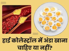 हाई कोलेस्ट्रॉल में अंडा खाना चाहिए या नहीं? जानें क्या है डायटीशियन की राय