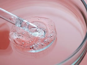 A Doctor Explains: What Is Glycolic Acid And How Does The Skin Benefit From Using It?