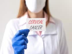 7 Myths Surrounding Cervical Cancer That Need To Be Busted