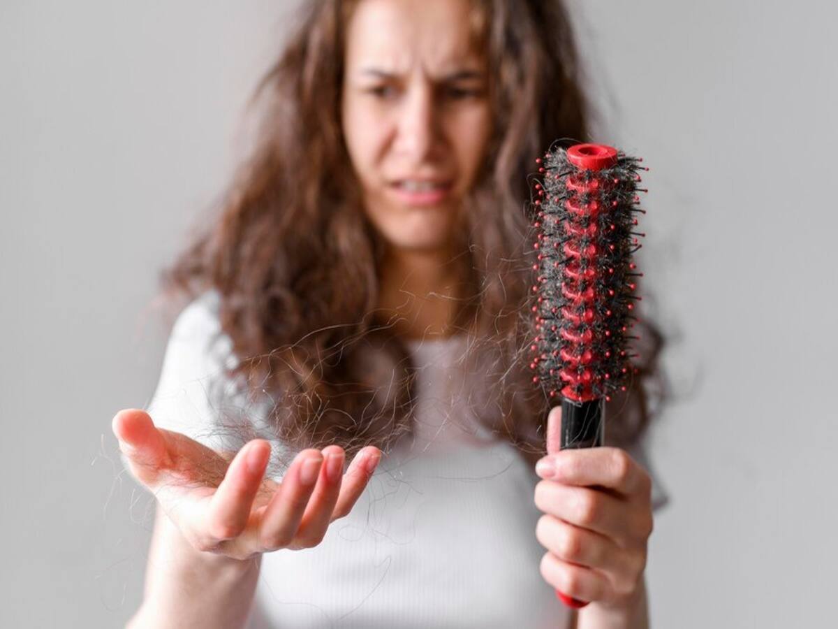 Everything To Know About Hair Fall In Women After 30 Causes, Treatment, Prevention