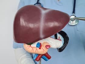 World Liver Day 2024: 4 Important Lifestyle Modifications To Mitigate Liver Disease
