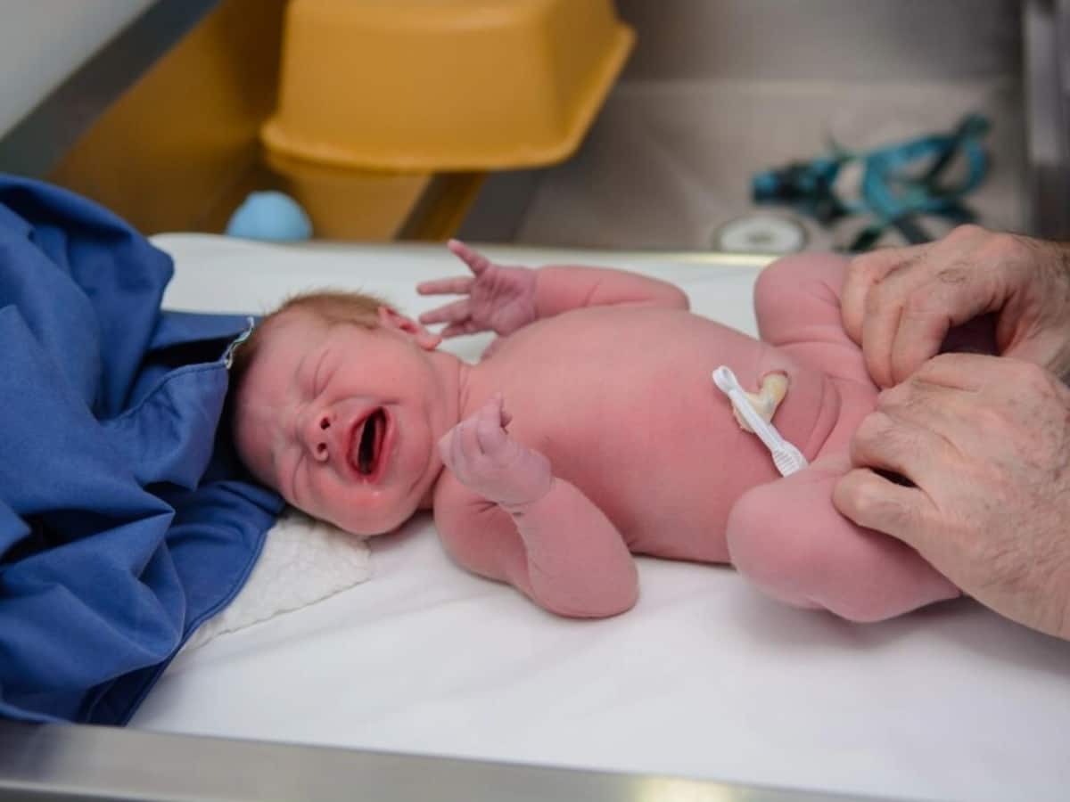 Newborn baby, Major surgeries, anorectal malformation (ARM), anal opening, surgery for anal opening in newborn, case study, newborn care, newborn health, newborn birth abnormality