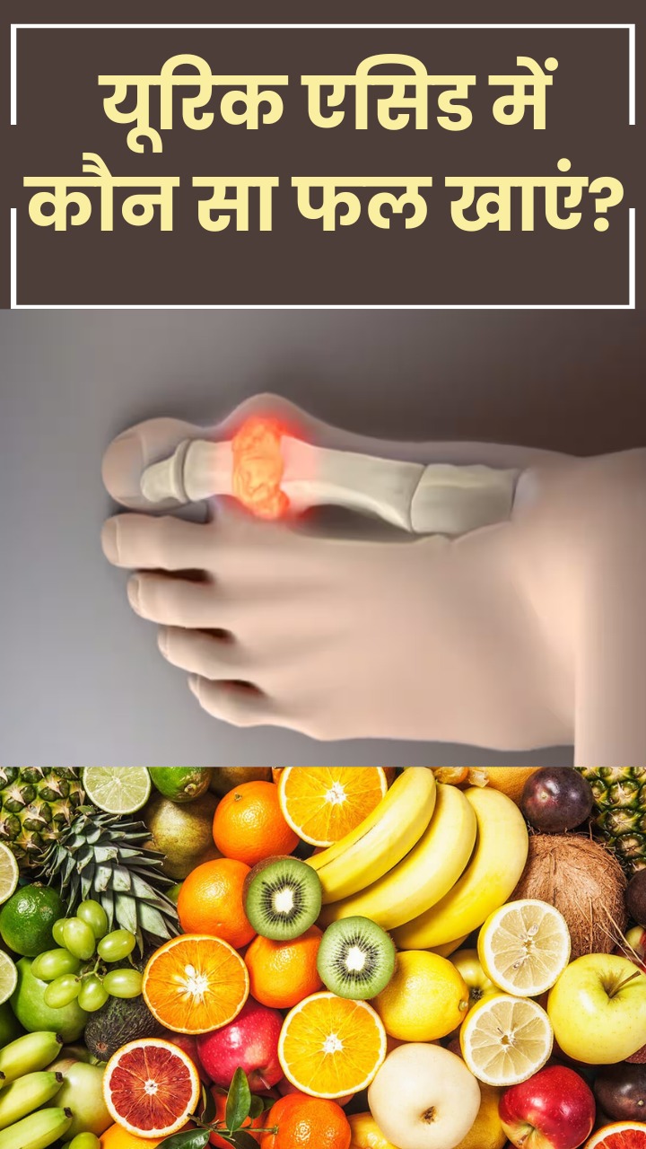 यूरिक एसिड में कौन सा फल खाना चाहिए?