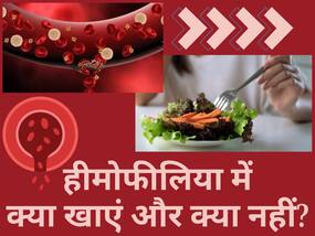 हीमोफीलिया के मरीजों की कैसी होनी चाहिए डाइट? एक्सपर्ट से जानें क्या खाना चाहिए और क्या नहींं? हीमोफीलिया के मरीजों की कैसी होनी चाहिए डाइट? एक्सपर्ट से जानें क्या खाना चाहिए और क्या नहींं?