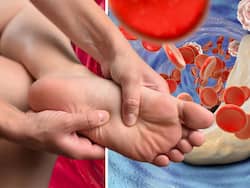 Vitamin B12 Deficiency Symptoms In Men 50s: Top 7 Signs of Vitamin B12 Deficiency In Legs and Feet At Night