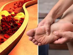 High Cholesterol Symptoms In Men 60s: Top 7 Unusual Signs of LDL Bad Cholesterol In Legs And Feet
