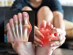 यूरिक एसिड के मरीज खाली पेट चबा लें ये 1 पत्ती, पेशाब के रास्ते निकल जाएगा सारा Uric Acid 