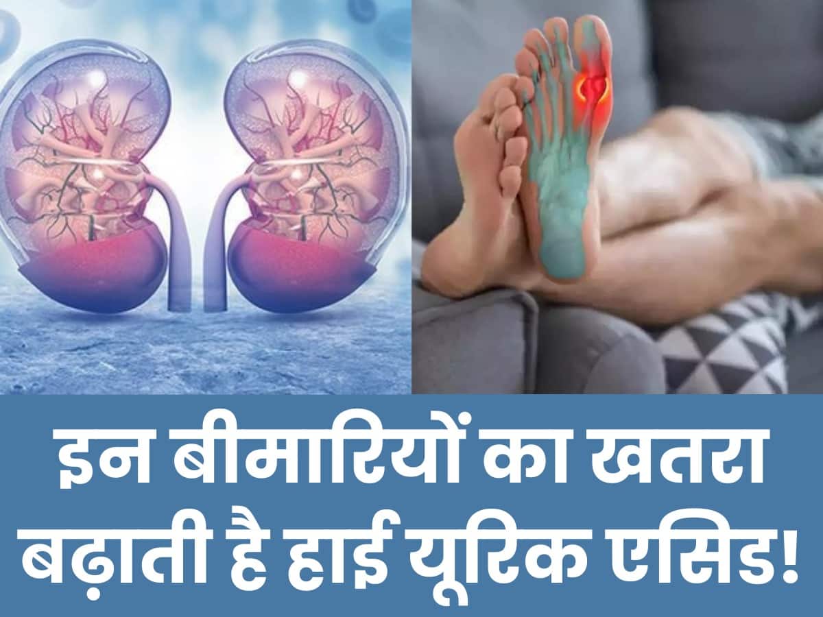 Uric acid badhne par kya hota hai Uric Acid बढ़ने पर इन 3 बीमारियों